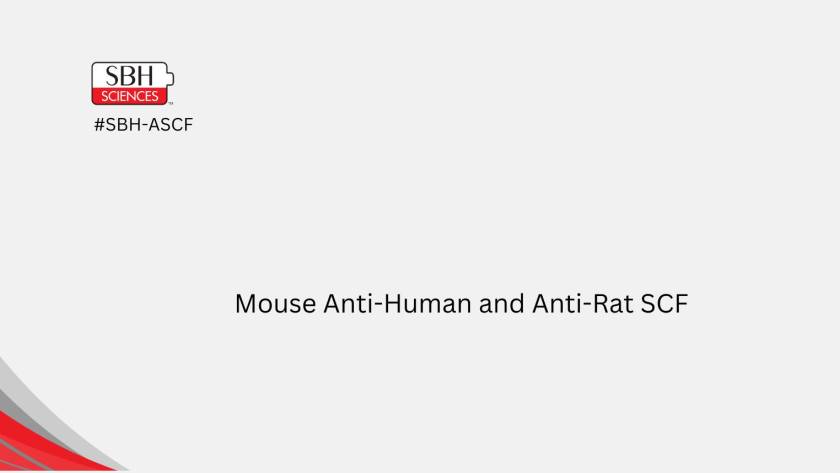 Mouse Anti-Human and Anti-Rat SCF Monoclonal Antibody